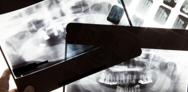 Combining Claims Processing with X-ray Scanning — How Hard Can It Be?